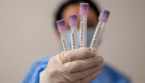 profesorden-dikkat-ceken-hantavirus-aciklamasi-yeniden-bir-pandemi-ihtimali-yok-ama-tedbir-sart-GOb5IcN5-1